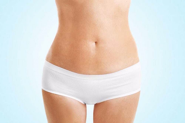 Después - abdominoplastia
