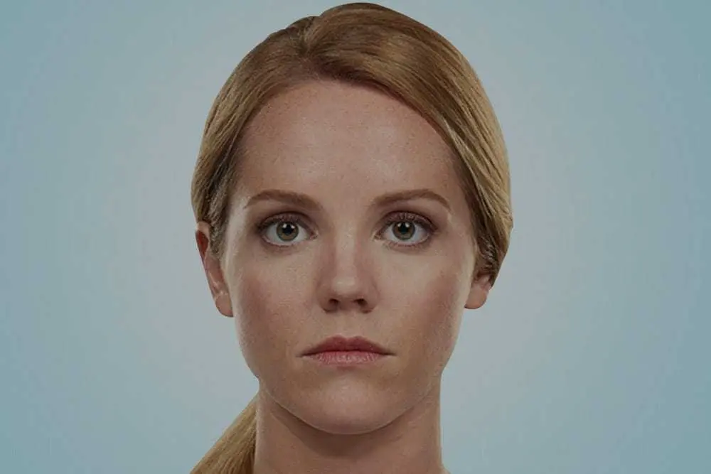 Antes - rejuvenecimientofacial